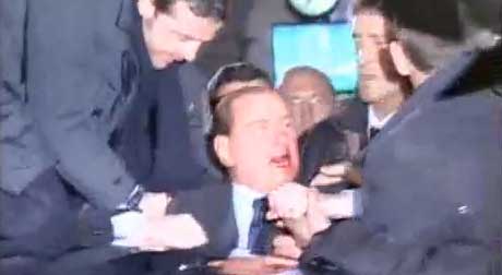 Le immagini del dopo aggressione a Silvio Berlusconi